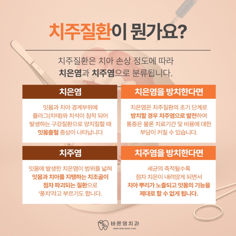 금호동치과, 잇몸 피나고 시린 치주질환 스케일링으로 예방해요 관련 이미지 6