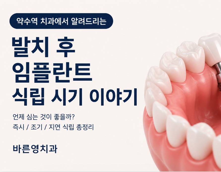 약수역 치과 발치후 임플란트 식립시기는 어떻게 정해질까요? 관련 이미지 1
