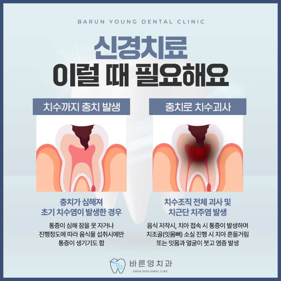 신당역치과 충치치료 자연치아 살리려는 것을 우선으로 관련 이미지 9