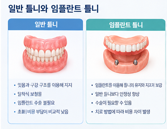 약수역 치과 임플란트와 틀니 차이, 어떤 치료가 나에게 맞을까요? 관련 이미지 3
