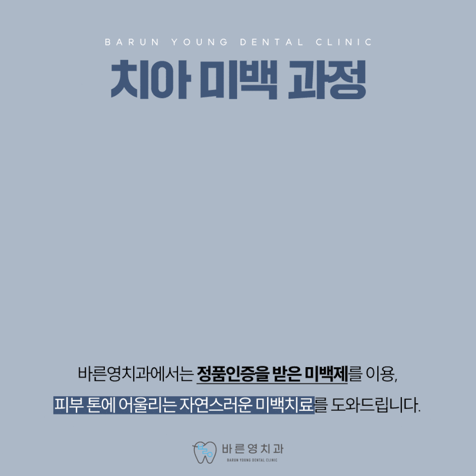 약수동치과 내게 맞는 치아미백으로 자신감 있게 관련 이미지 9
