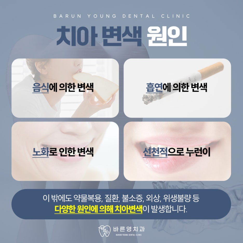 약수동치과 내게 맞는 치아미백으로 자신감 있게 관련 이미지 4