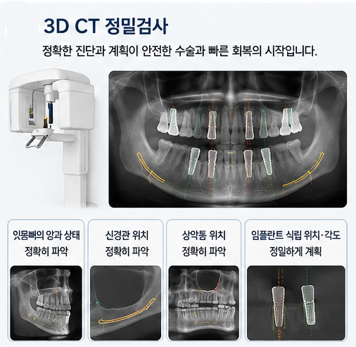 약수역 전체임플란트, 임플란트 수술은 얼마나 아플까요? 관련 이미지 4