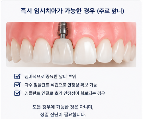 약수역 치과 발치후 임플란트 식립시기는 어떻게 정해질까요? 관련 이미지 6
