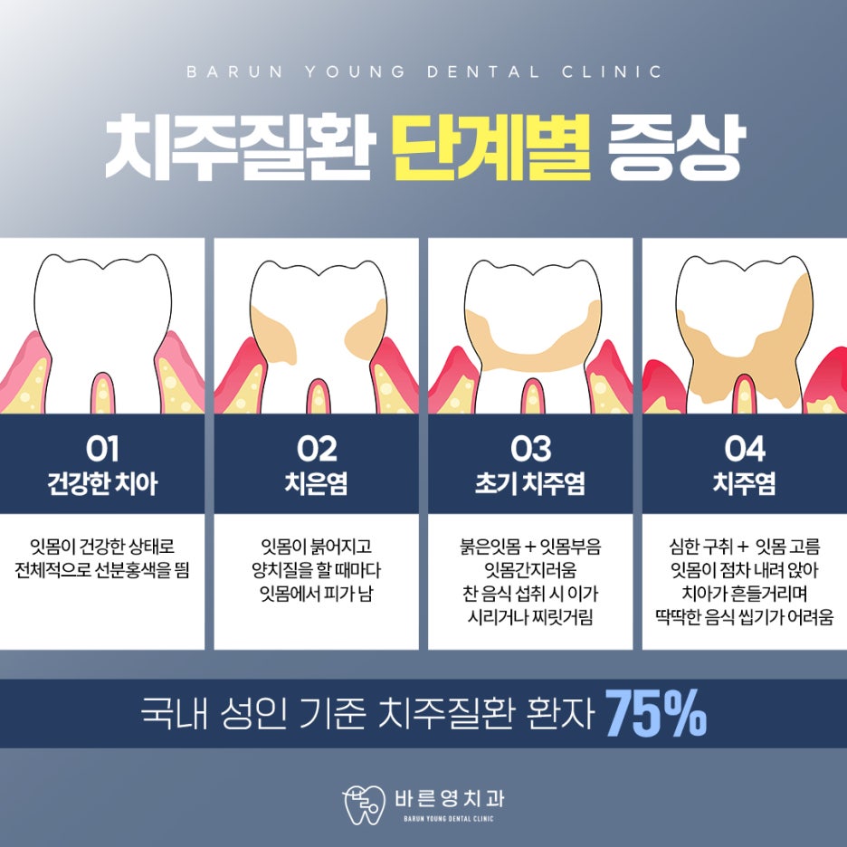 옥수역치과 붓고 피나는 잇몸 치료시기 놓치지 말아야 관련 이미지 8