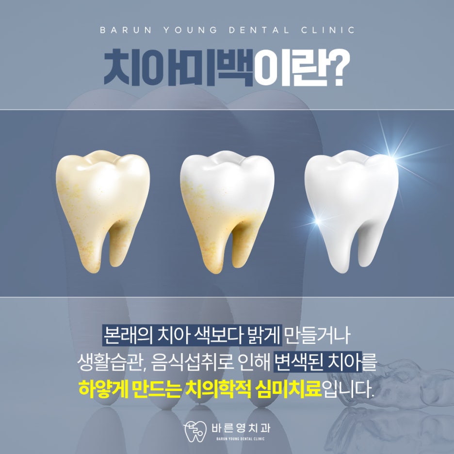금호동치과 자연스러운 치아미백 치료를 돕는 바른영치과 관련 이미지 1