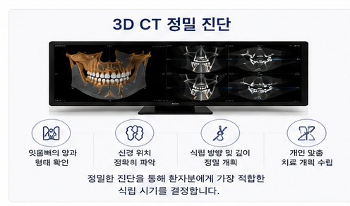 약수역 치과 발치후 임플란트 식립시기는 어떻게 정해질까요? 관련 이미지 7