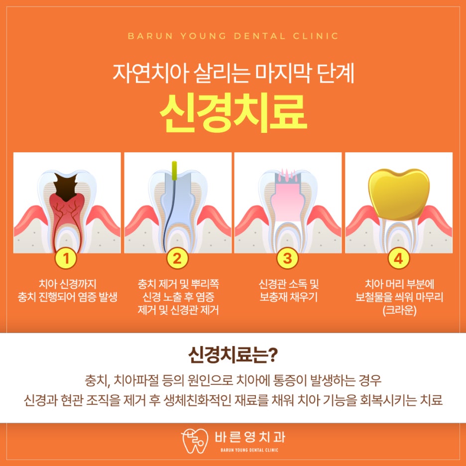 약수역치과 시리고 아픈 치아 충치치료 미루지 말고 빠르게 관련 이미지 8