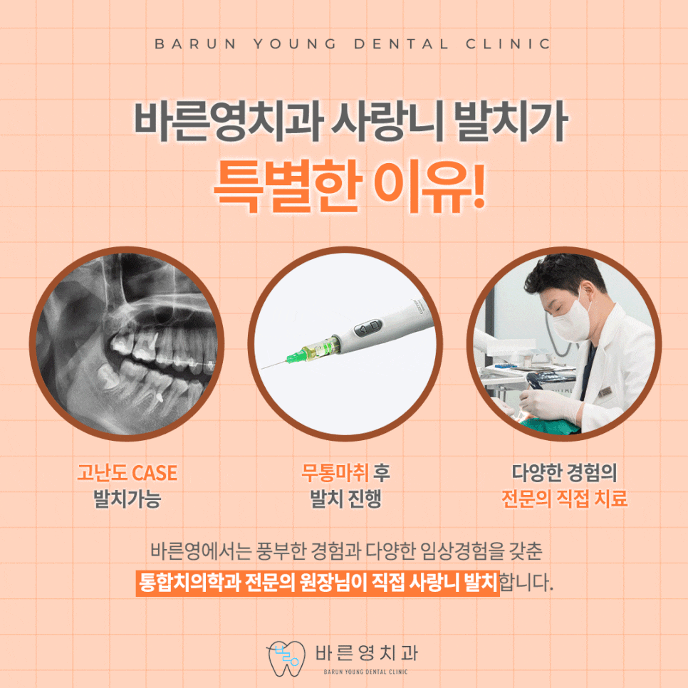 다산동치과, 사랑니 당일 발치 가능한 치과 찾는다면 관련 이미지 8