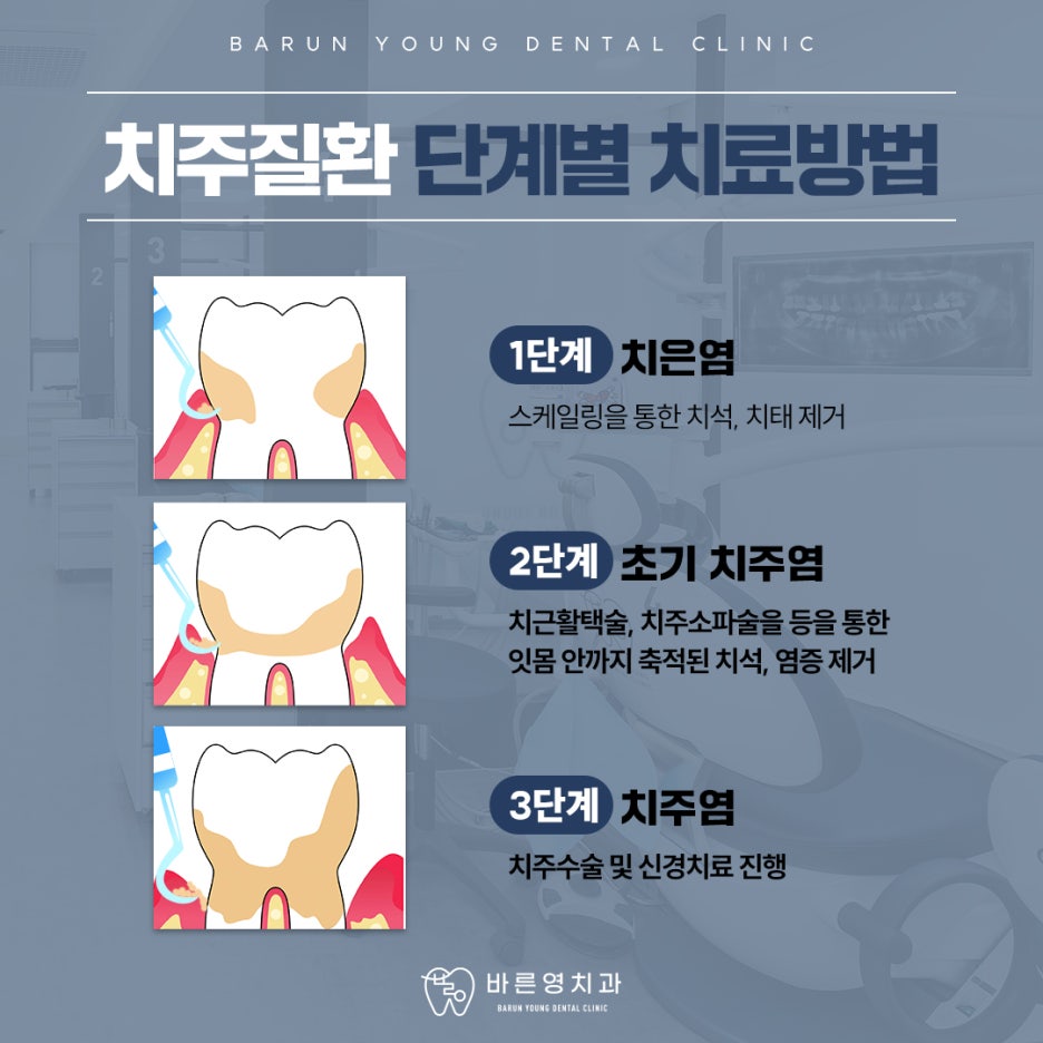 옥수역치과 붓고 피나는 잇몸 치료시기 놓치지 말아야 관련 이미지 9