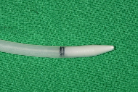 신당동 치과 오래전 빠진 치아 상태에서 임플란트 수술(상악동 거상술) 관련 이미지 5