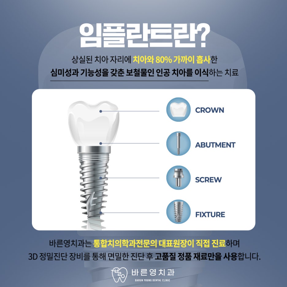 금호역치과 미리 경로 알고 식립하는 네비게이션 임플란트 관련 이미지 5