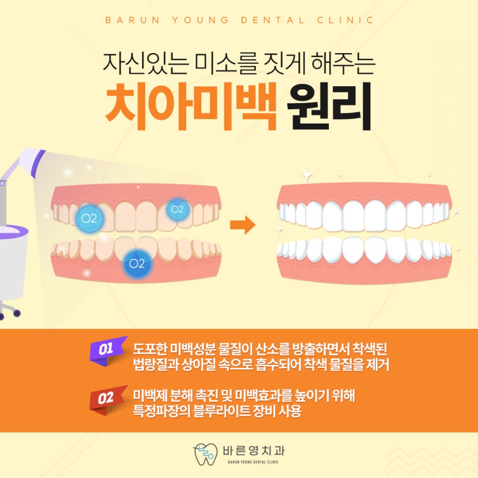 신당역치과 치아미백, 구강건강까지 지킬 수 있어야 관련 이미지 6
