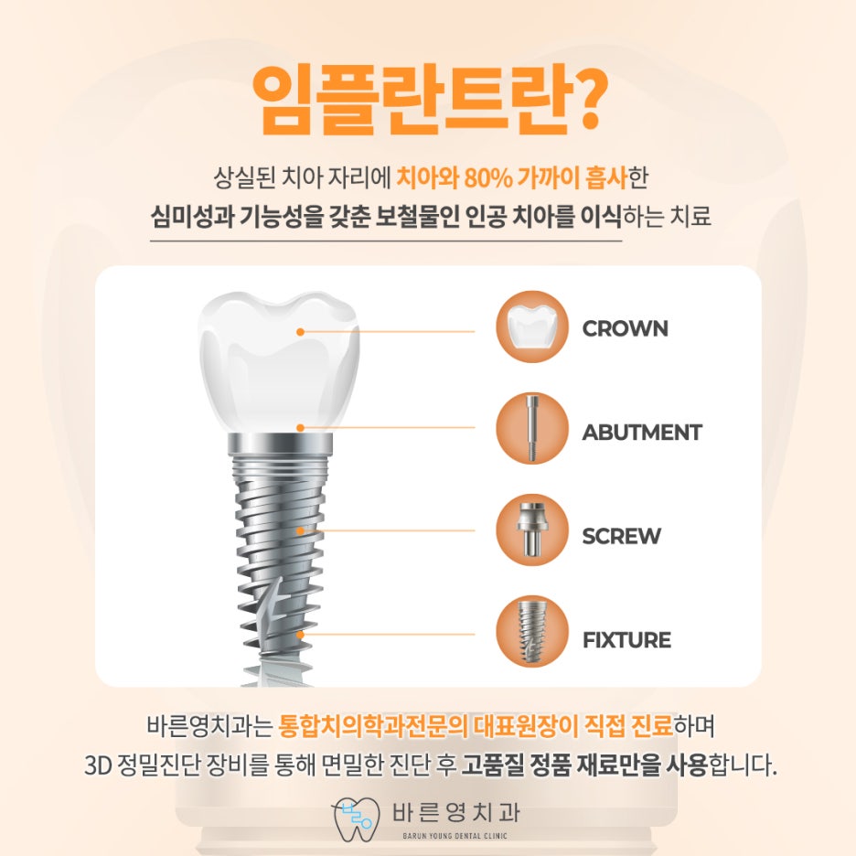 신금호역치과, 경로를 미리 파악하고 진행하는 네비게이션임플란트 관련 이미지 4