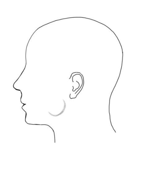 신당동 치과, 턱 보톡스 주사 이후에 나타날 수 있는 증상 ( 사각턱, 저작근, 볼 알사탕 현상) 관련 이미지 3