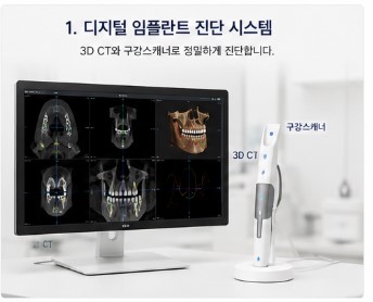 약수역치과 디지털 장비를 이용한 효율적인 임플란트 수술 및 장점 관련 이미지 1