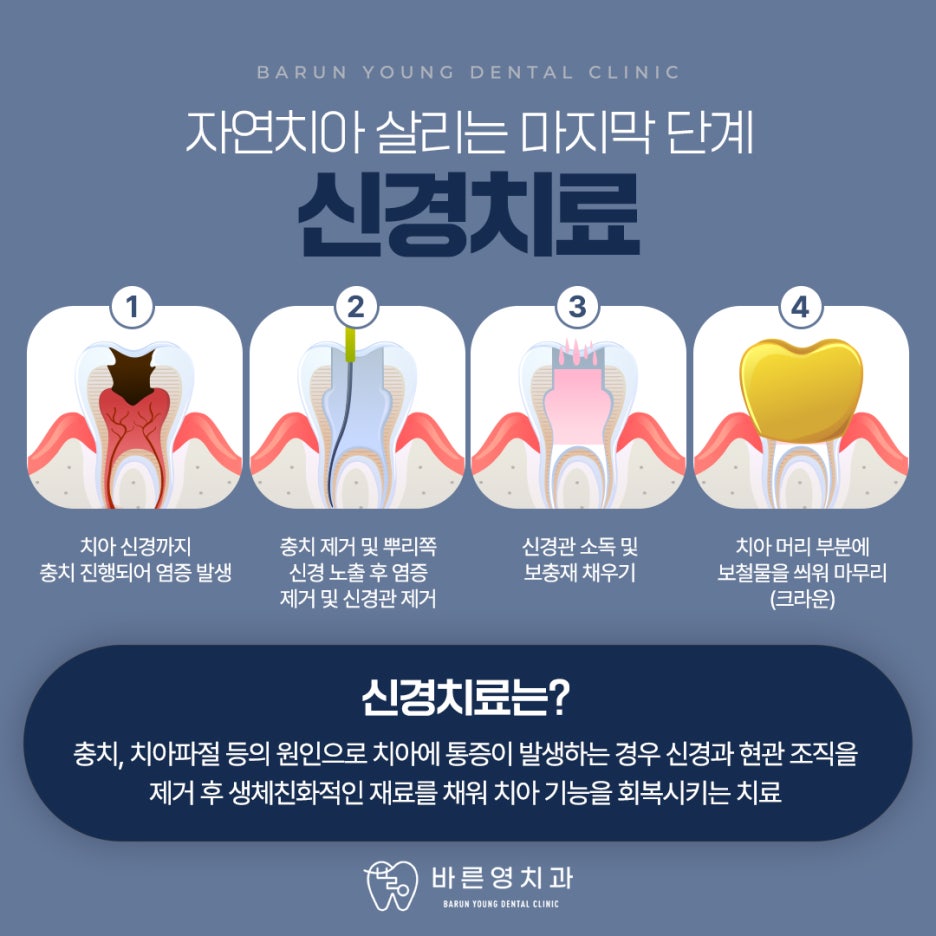 신당역치과 충치치료 자연치아 살리려는 것을 우선으로 관련 이미지 10