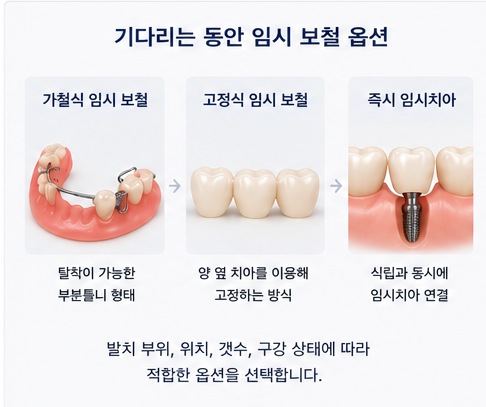 약수역 치과 발치후 임플란트 식립시기는 어떻게 정해질까요? 관련 이미지 5