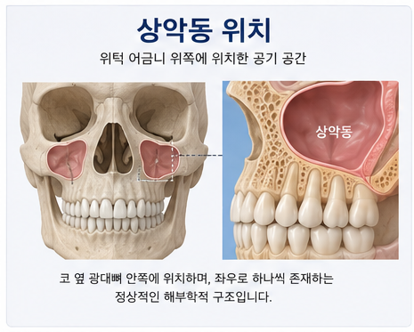 Yak-su Station Dental Clinic: When Is a Sinus Lift Necessary for Implants? image 1
