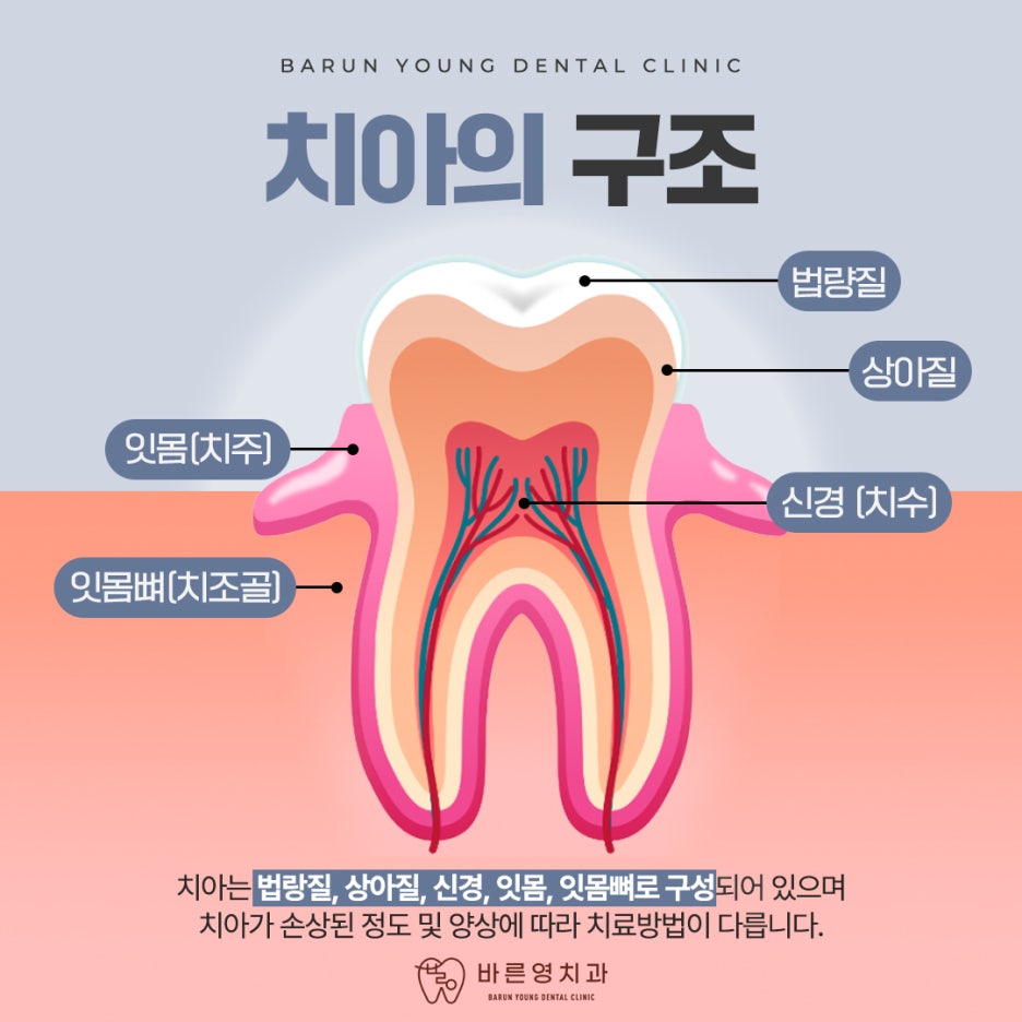 신당동치과 임플란트 비용만 보고 결정하지 말고 관련 이미지 5