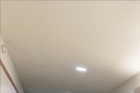 홍대 턱필러로 예쁜 얼굴라인을 관련 이미지 17