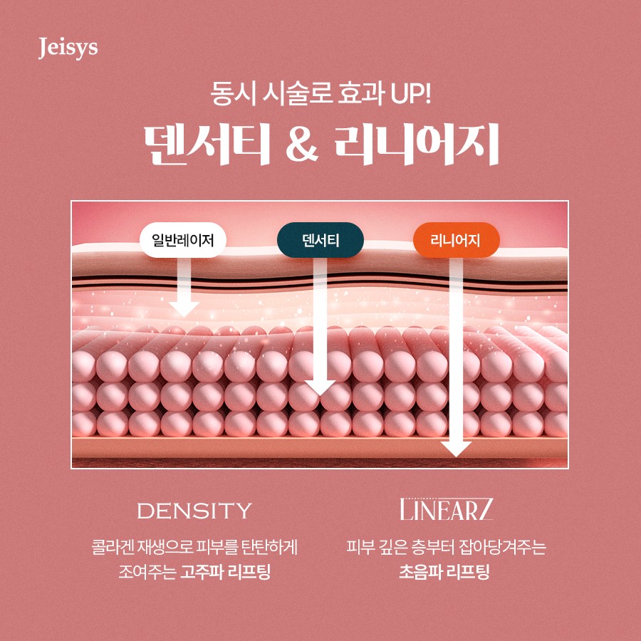 마리오네트주름 시술 고민? 덴서티지로 걱정 없이 관련 이미지 2