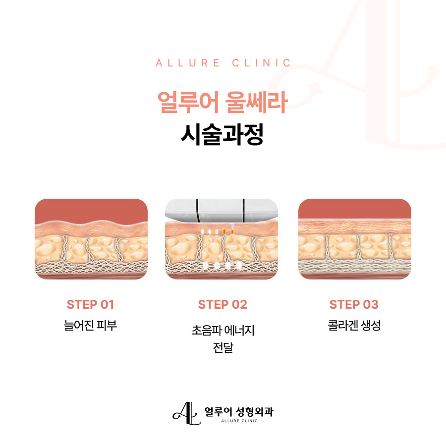 홍대입구 성형외과 울쎄라 리프팅으로 탄력 충전 관련 이미지 3