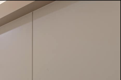 홍대 애교필러로 입체적인 동안 얼굴을! 관련 이미지 10