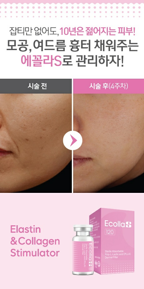 홍대입구역 스킨부스터 에꼴라s로 꼼꼼한 관리를 관련 이미지 3