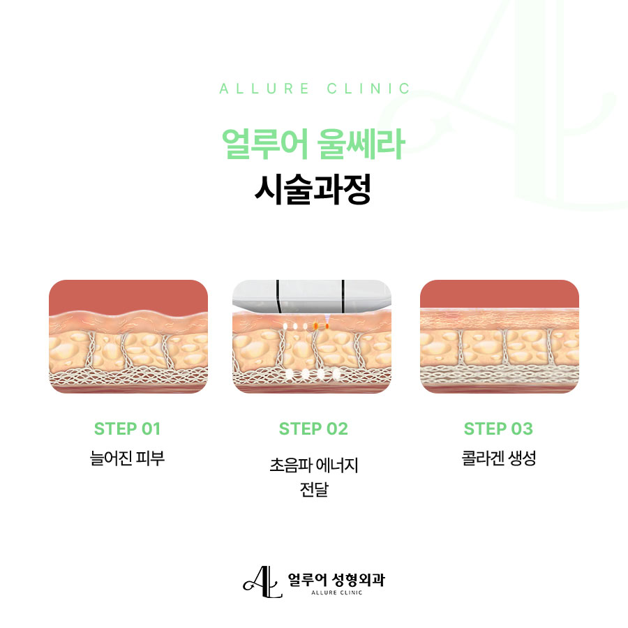 합정역 울쎄라 피부탄력을 높이려면 관련 이미지 3