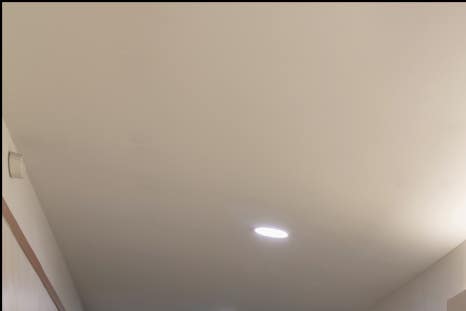 홍대 애교필러로 입체적인 동안 얼굴을! 관련 이미지 8
