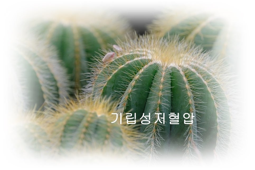 기립성저혈압 원인과 관리방법 관련 이미지 1