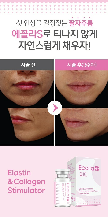홍대입구역 스킨부스터 에꼴라s로 꼼꼼한 관리를 관련 이미지 4