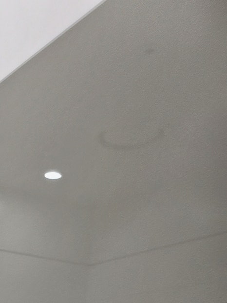 홍대입구역 입술필러로 만족스러운 입술을 관련 이미지 10