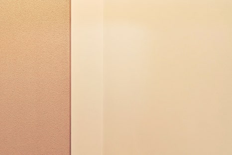 홍대 안검하수 졸려보이는 눈이 스트레스라면 관련 이미지 13