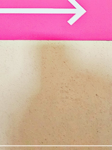 홍대 울쎄라 리프팅 깔끔한 얼굴라인 만들기 관련 이미지 15