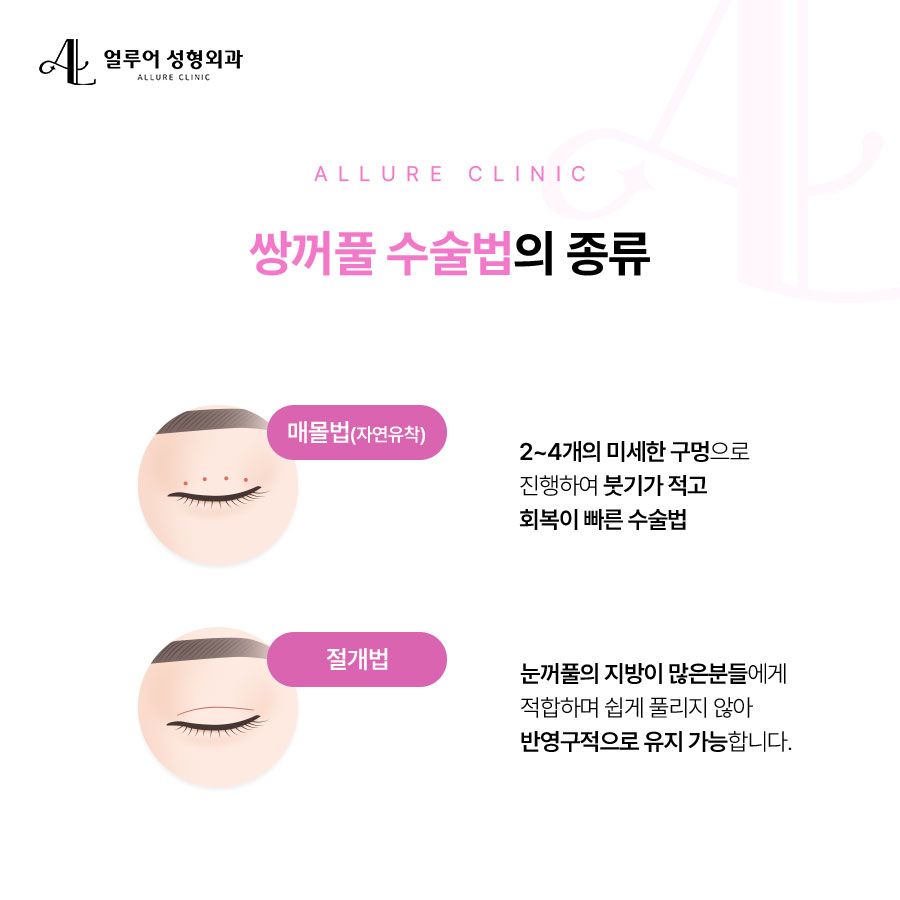 신촌역 성형외과 쌍꺼풀 수술은 성형외과 전문의와 관련 이미지 2