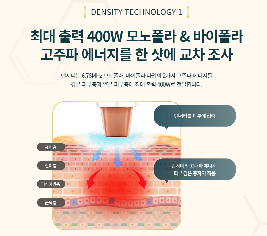 리프팅시술 덴서티, 2가지 고주파로 관련 이미지 4