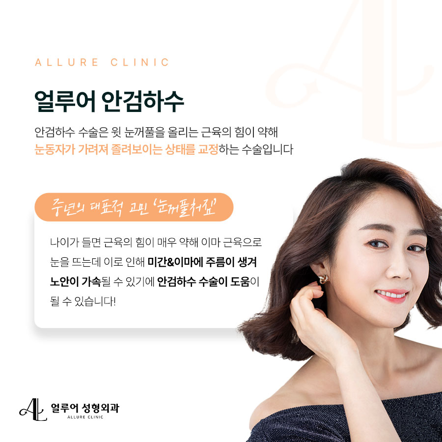홍대 안검하수 졸려보이는 눈이 스트레스라면 관련 이미지 2