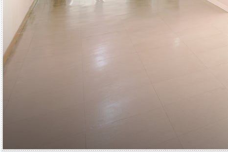 홍대입구역 울쎄라 리프팅으로 피부탄력 높이기 관련 이미지 23