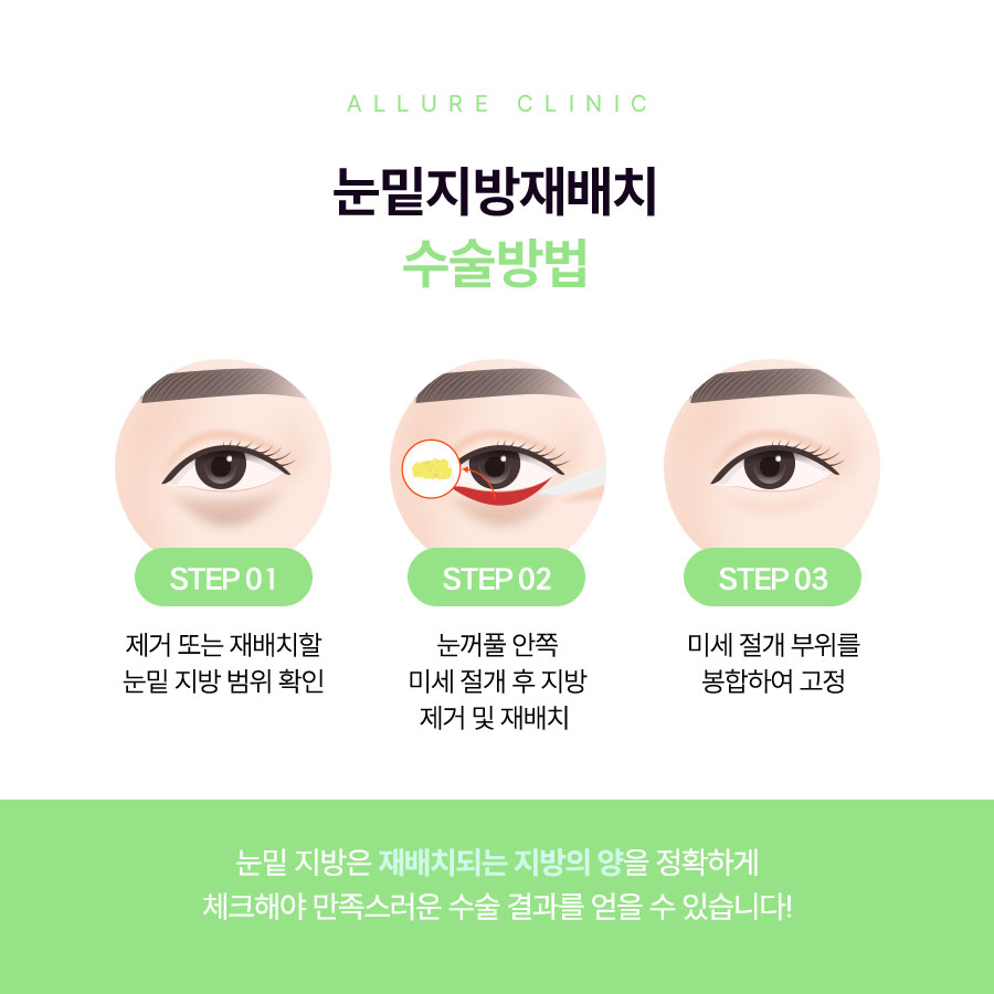 합정역 성형외과 눈밑지방재배치 고민중이라면? 관련 이미지 3