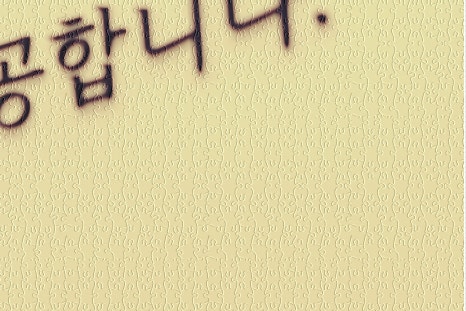 연남동 성형외과 눈성형 잘하는곳에서 시작하세요 관련 이미지 22
