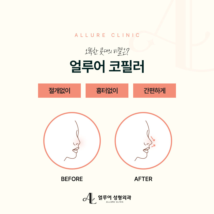 홍대 코필러로 수술 없이 예쁜 코를 관련 이미지 2