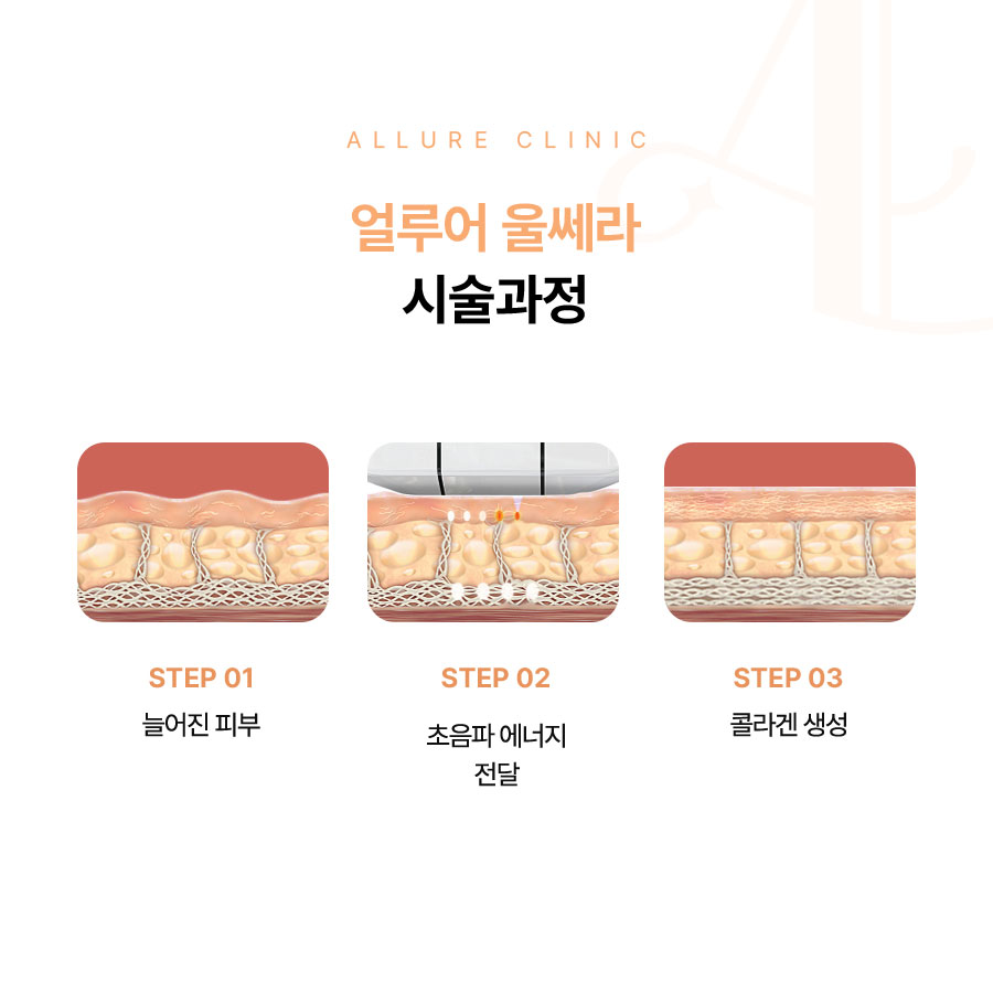 홍대 성형외과 추천 매끈한 얼굴 라인을 위해서 관련 이미지 3