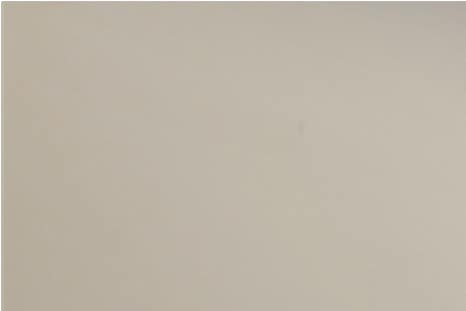홍대 이마필러로 입체적인 얼굴을! 관련 이미지 8