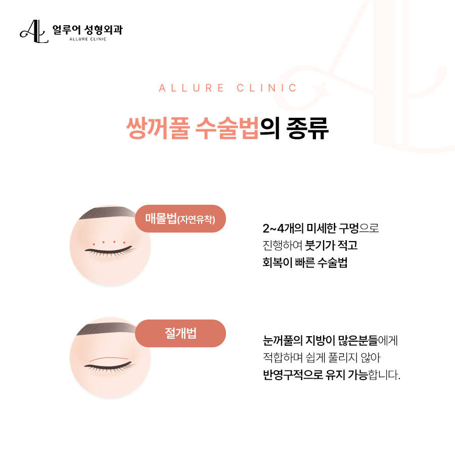 홍대 눈성형 맞춤형 쌍꺼풀 수술로! 관련 이미지 3