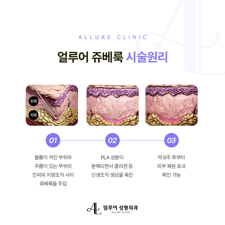 홍대입구 쥬베룩 관리가 필요하다면 관련 이미지 3