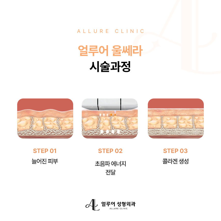 홍대 울쎄라 강력한 리프팅을 원한다면 관련 이미지 3