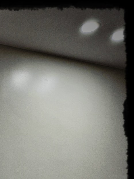 홍대 보톡스, 아름다운 라인을 만들고 싶다면 관련 이미지 10