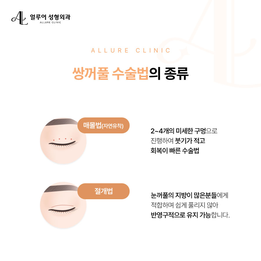 합정역 눈성형 자연스러운 결과로 입증된 곳 관련 이미지 2